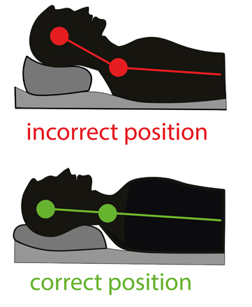 Diagram showing incorrect and correct pillow positions for back sleepers, highlighting neck alignment and spinal support.