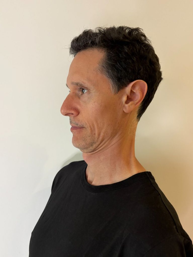 Patient performing chin retraction against a wall with foam roller to correct forward head posture.
