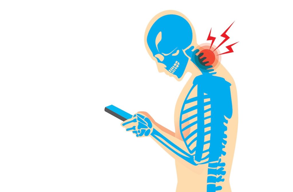 Forward head posture illustration with neck pain