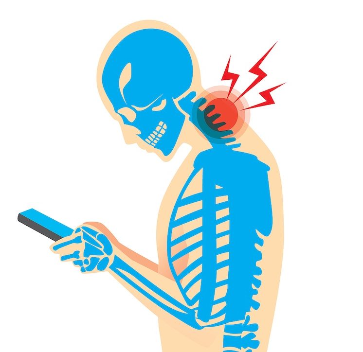 Forward head posture illustration with neck pain