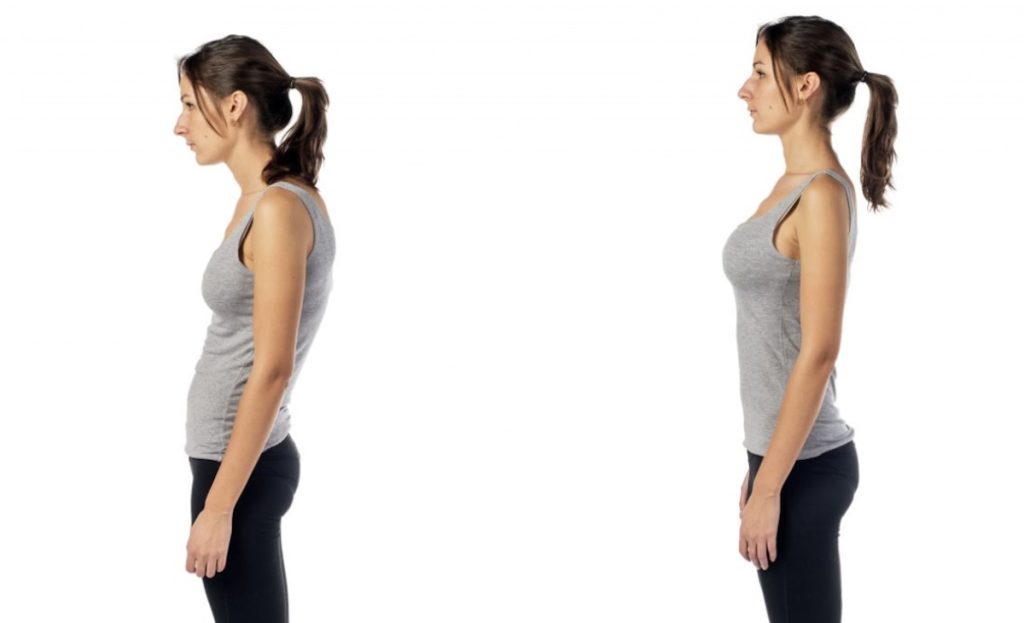 Before and after posture alignment showing improved spinal balance