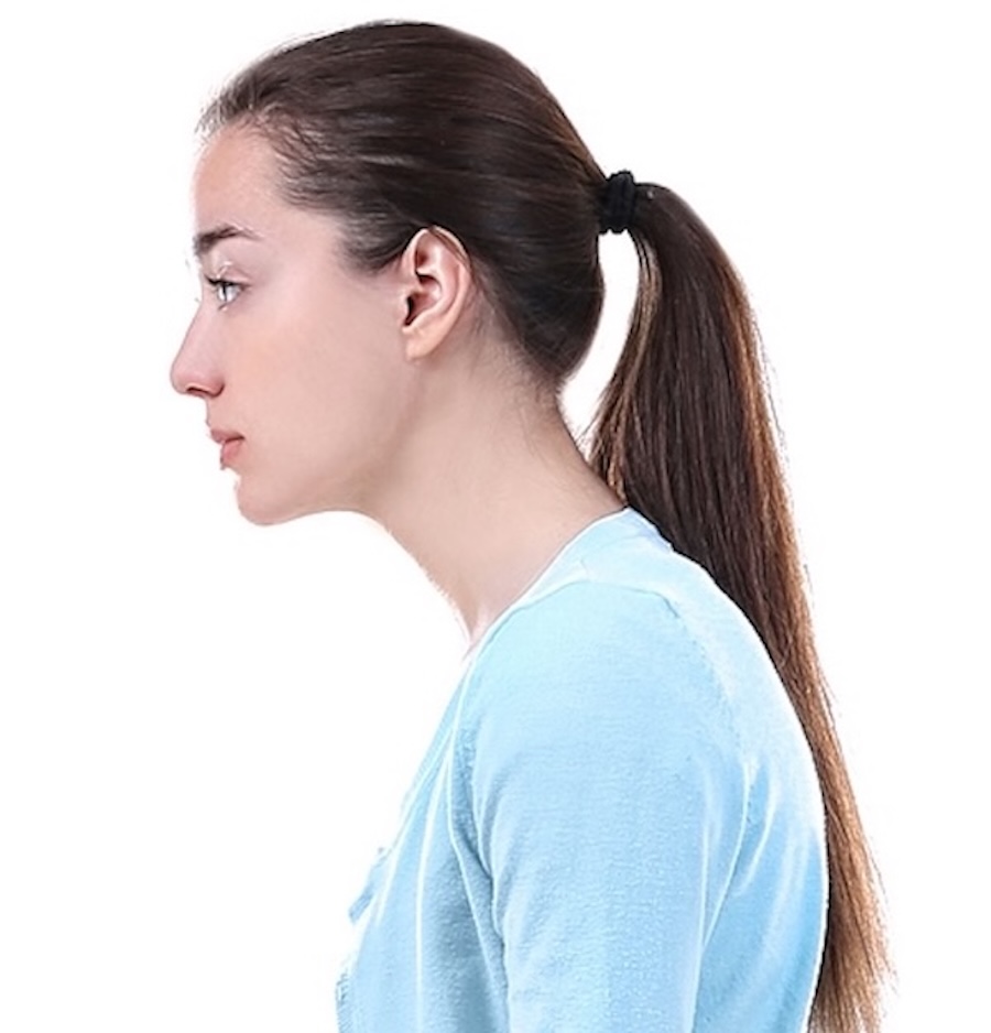 Person showing forward head posture which is often causes neck pain.